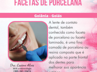 FACETAS PORCELANA GOIANIA GOIAS